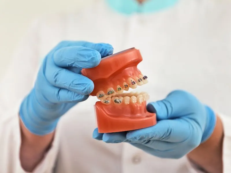 Best Braces & Aligners for Teeth Straightening in Karve Nagar & Baner - My Family Dental Clinic