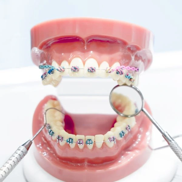 Orthodontic Treatment in Karve Nagar