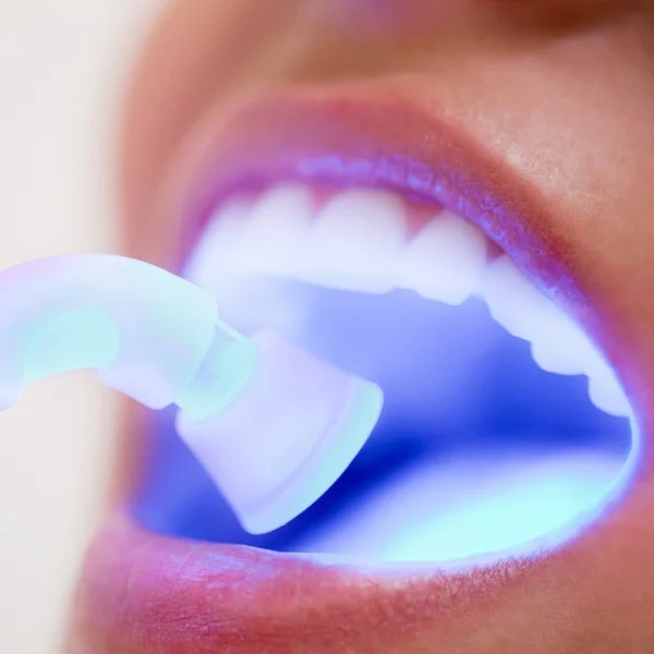 Advanced Cosmetic Dental Clinic near you in Erandwane, Kothrud